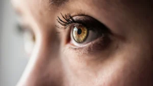 nistagmus vertigo merkezi